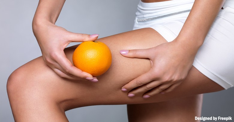 CELLULITE, RITENZIONE E …&nbsp;ALIMENTAZIONE