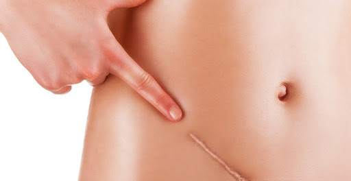 LA CICATRICE: UNA FERITA CHE&nbsp;COMUNICA