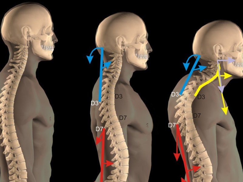 ALTERAZIONE DELLA POSTURA SU BASE&nbsp;PSICOLOGICA
