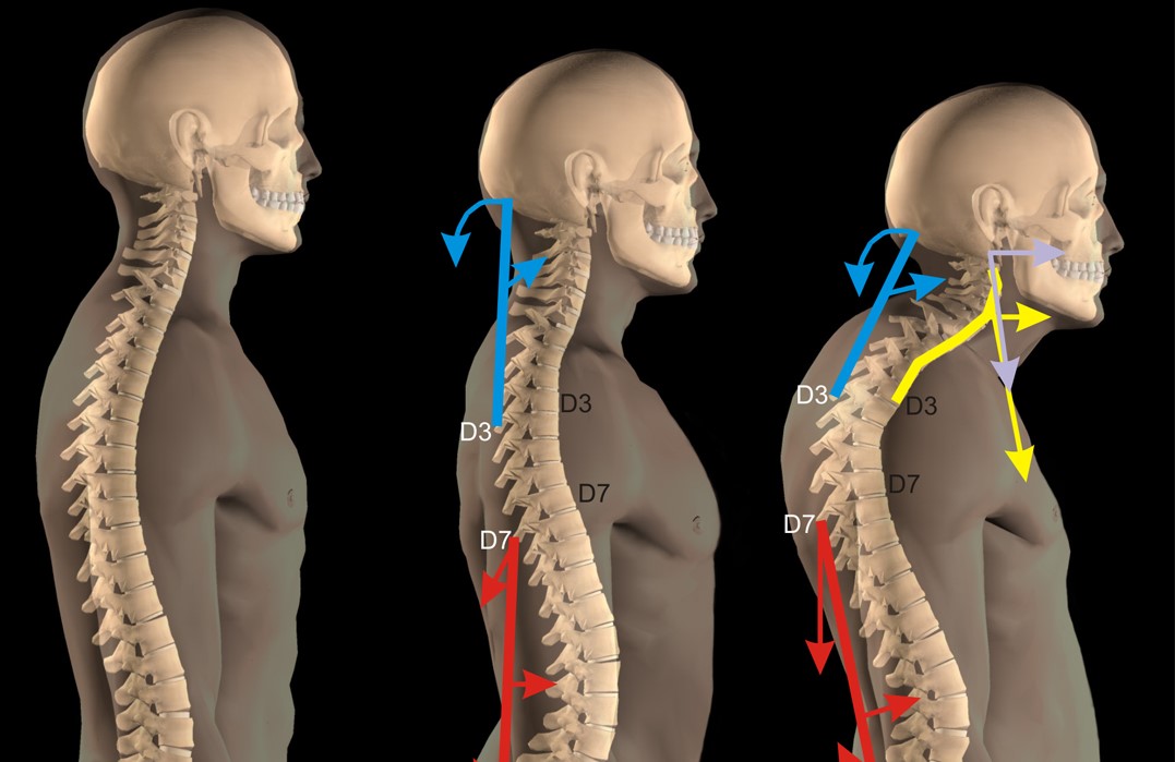 ALTERAZIONE DELLA POSTURA SU BASE&nbsp;PSICOLOGICA