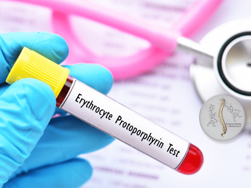 PROTOPORFIRIA ERITROPOIETICA: CONOSCIAMOLA&nbsp;MEGLIO